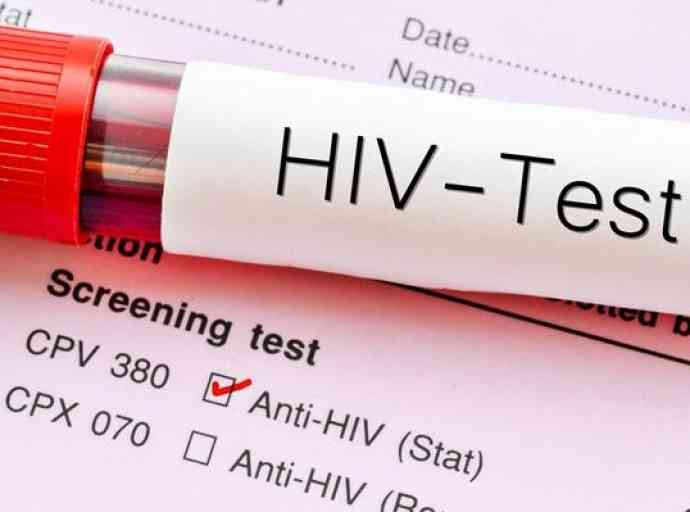 hiv-test