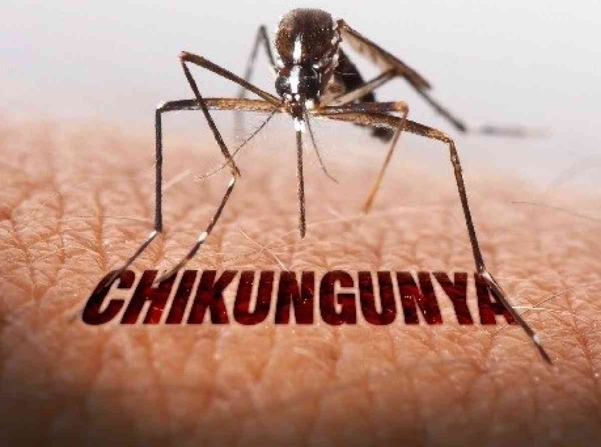 චිකන්ගුන්‍යා වසංගතය පාලනයට රසායනාගාර පරීක්ෂණ අත්‍යවශ්‍යයි