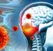 මෙනින්ජිටිස් (Enteroviral Meningitis) රෝගී තත්ත්වය පැතිරීම සහ වැළැක්වා ගැනීමට විශේෂ උපදෙස් මාලාවක්